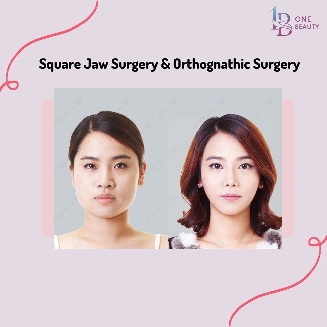 Post 2 by One Beauty Korea on Instagram (image)