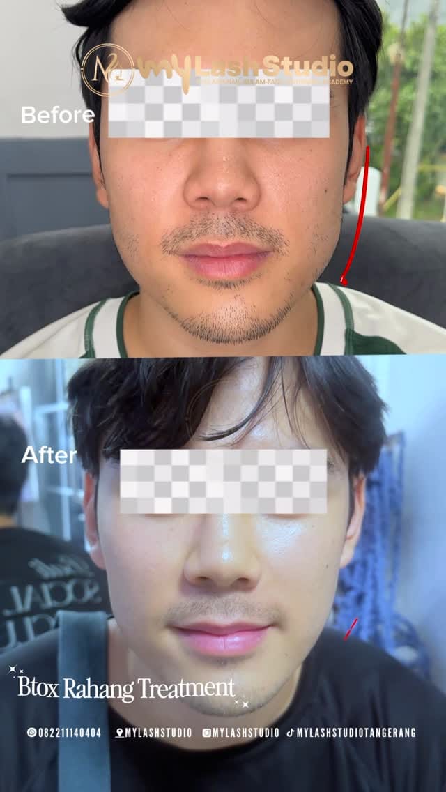 Post 3 by MY LASH STUDIO - SULAM - NAIL - WHITENING on Instagram (video)