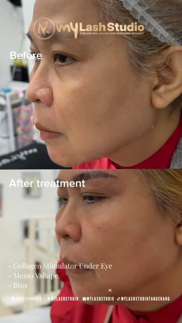 Post 2 by MY LASH STUDIO - SULAM - NAIL - WHITENING on Instagram (video)