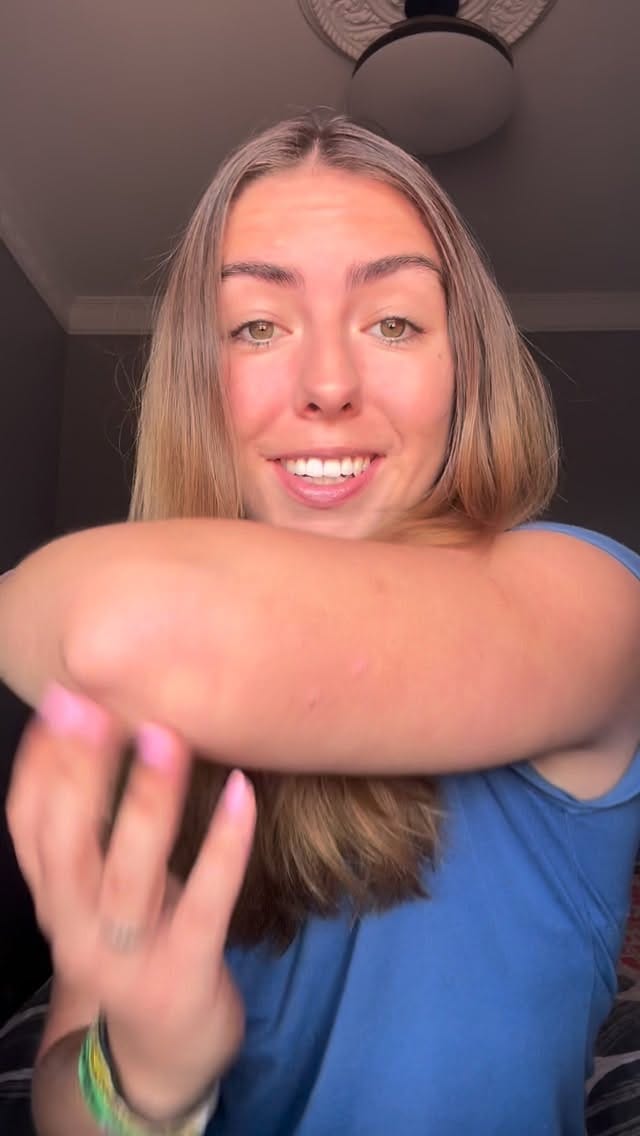 Post 9 by Psoriasis Advocate and Model - Bree Pease on Instagram (video)