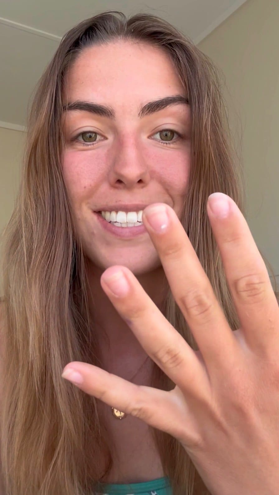 Post 7 by Psoriasis Advocate and Model - Bree Pease on Instagram (video)
