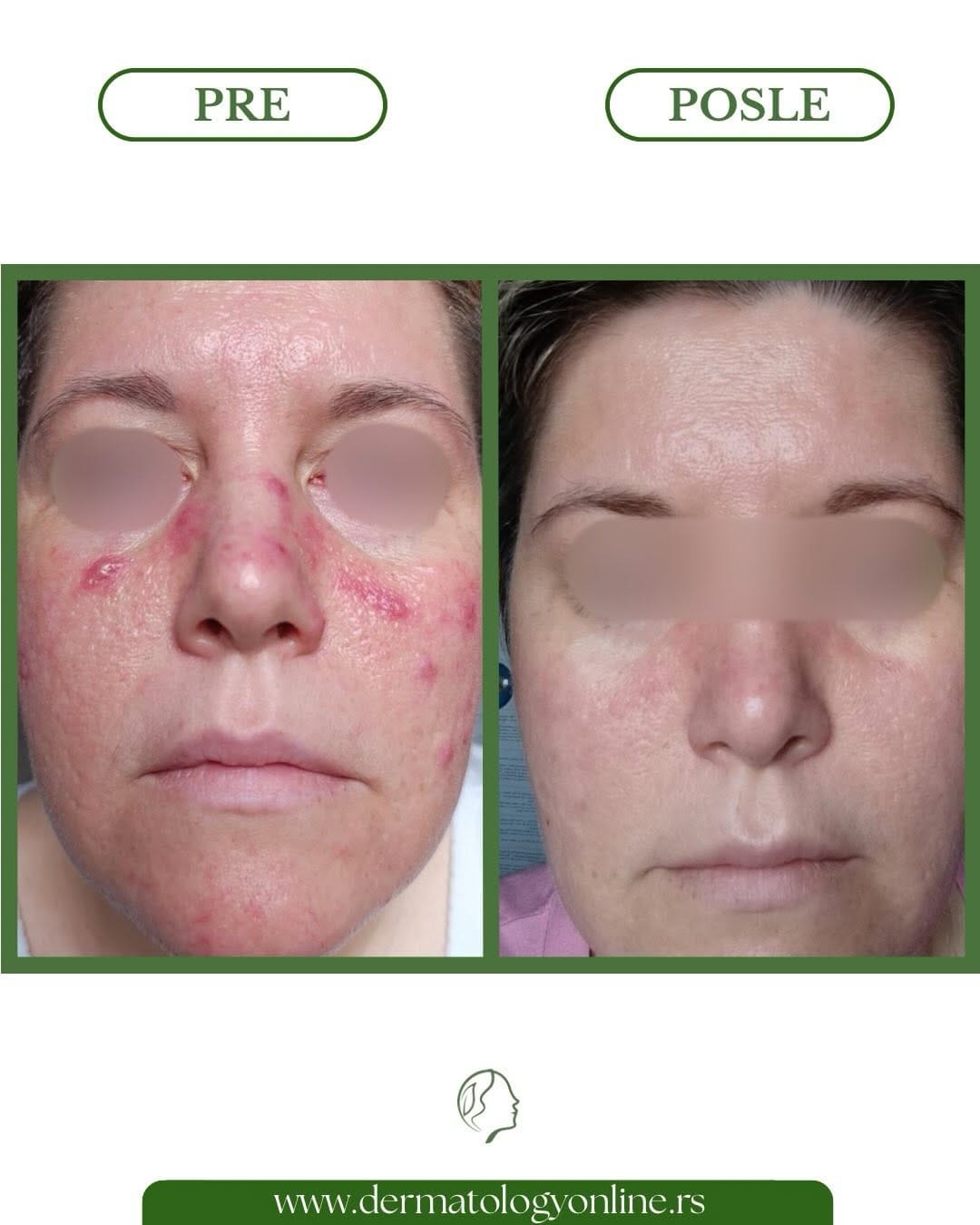Post 7 by Dermatolog Online on Instagram (carousel)
