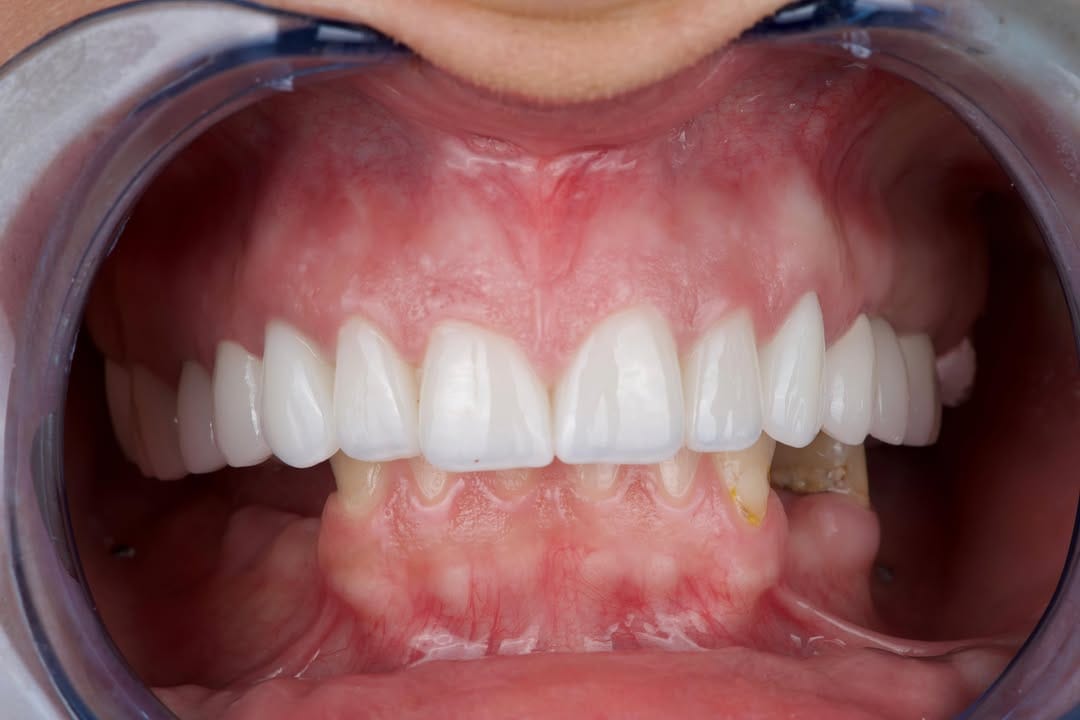 Post 7 by STOMA | Dental & Aesthetic Centar on Instagram (image)