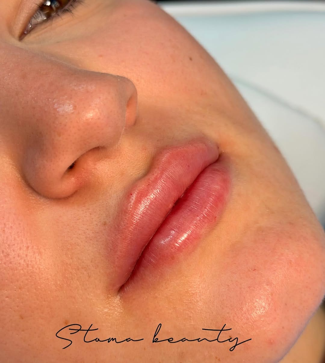 Post 1 by STOMA | Dental & Aesthetic Centar on Instagram (image)