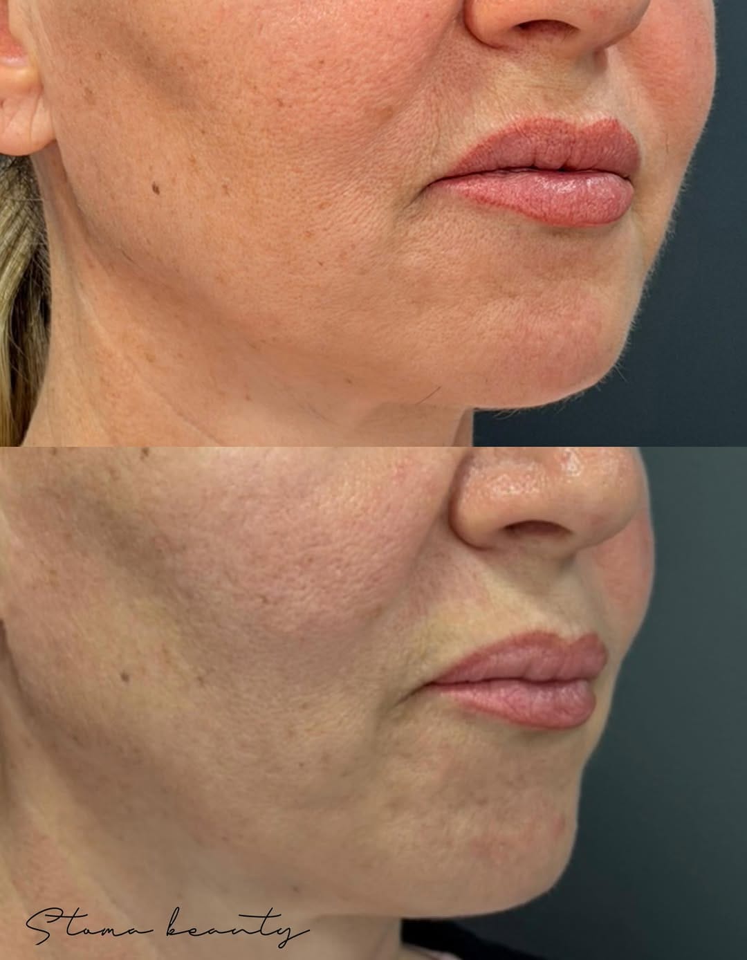 Post 6 by STOMA | Dental & Aesthetic Centar on Instagram (image)