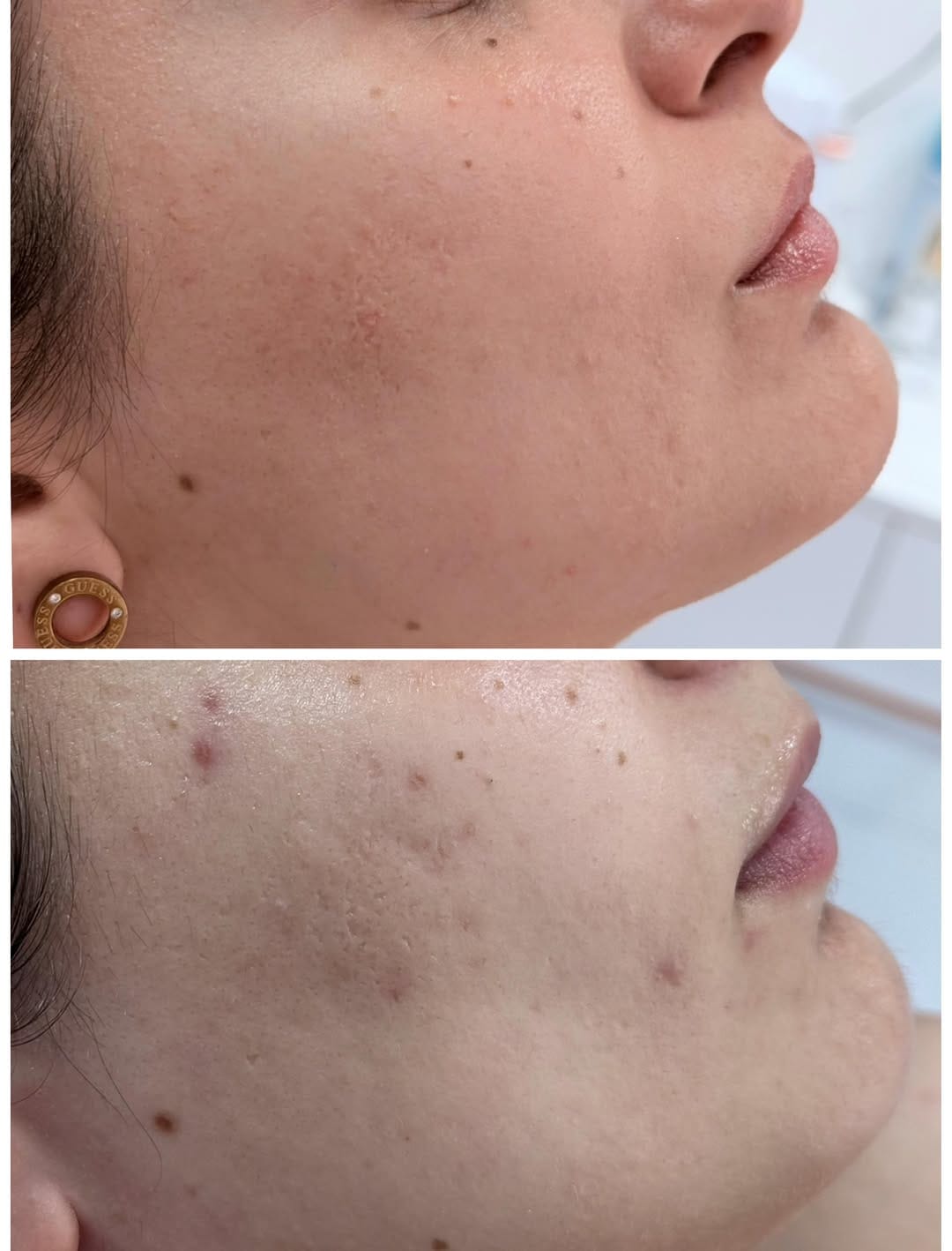 Post 4 by STOMA | Dental & Aesthetic Centar on Instagram (carousel)