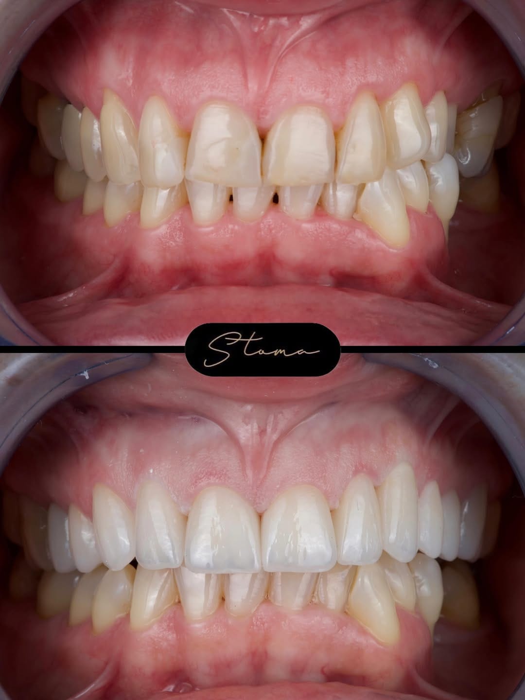 Post 5 by STOMA | Dental & Aesthetic Centar on Instagram (image)