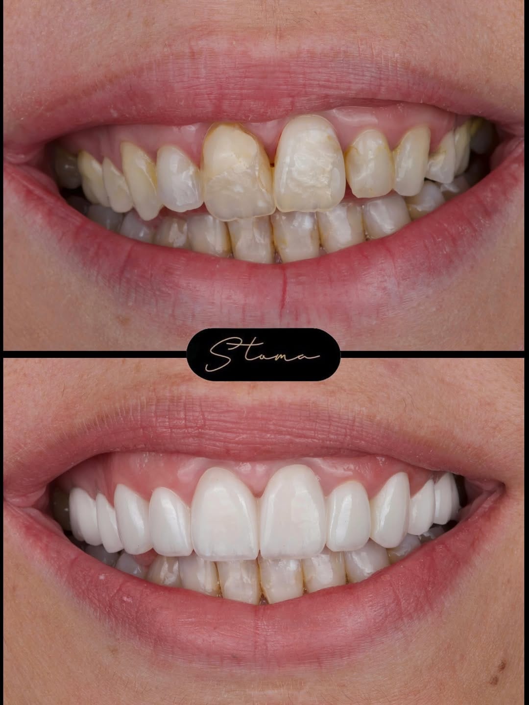 Post 2 by STOMA | Dental & Aesthetic Centar on Instagram (carousel)