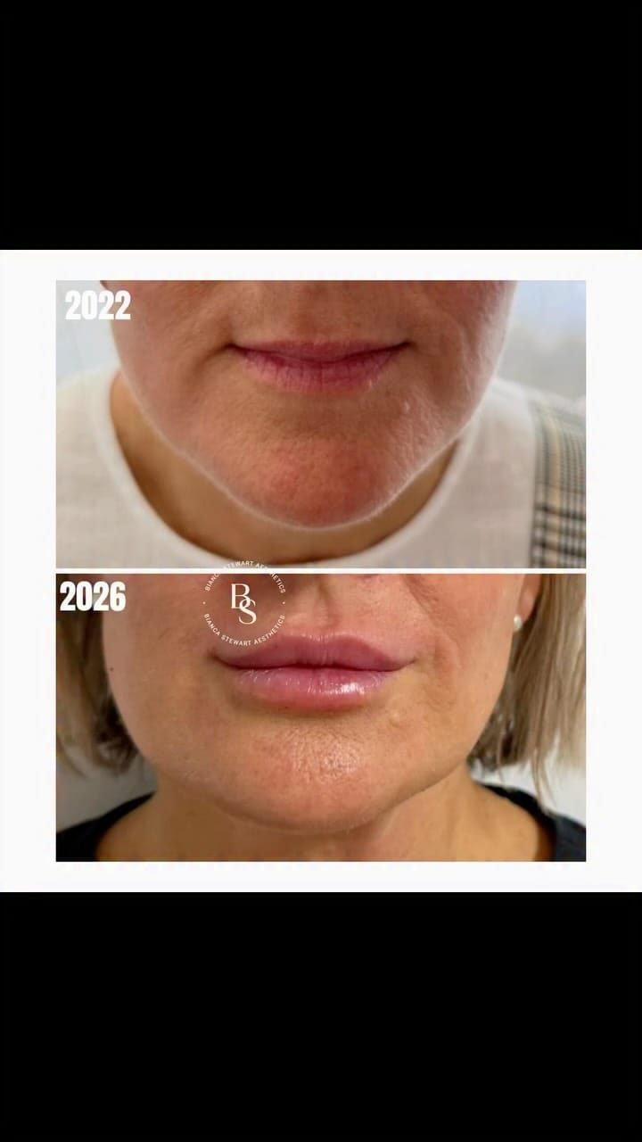 Post 4 by Bianca Stewart Aesthetics on Instagram (video)