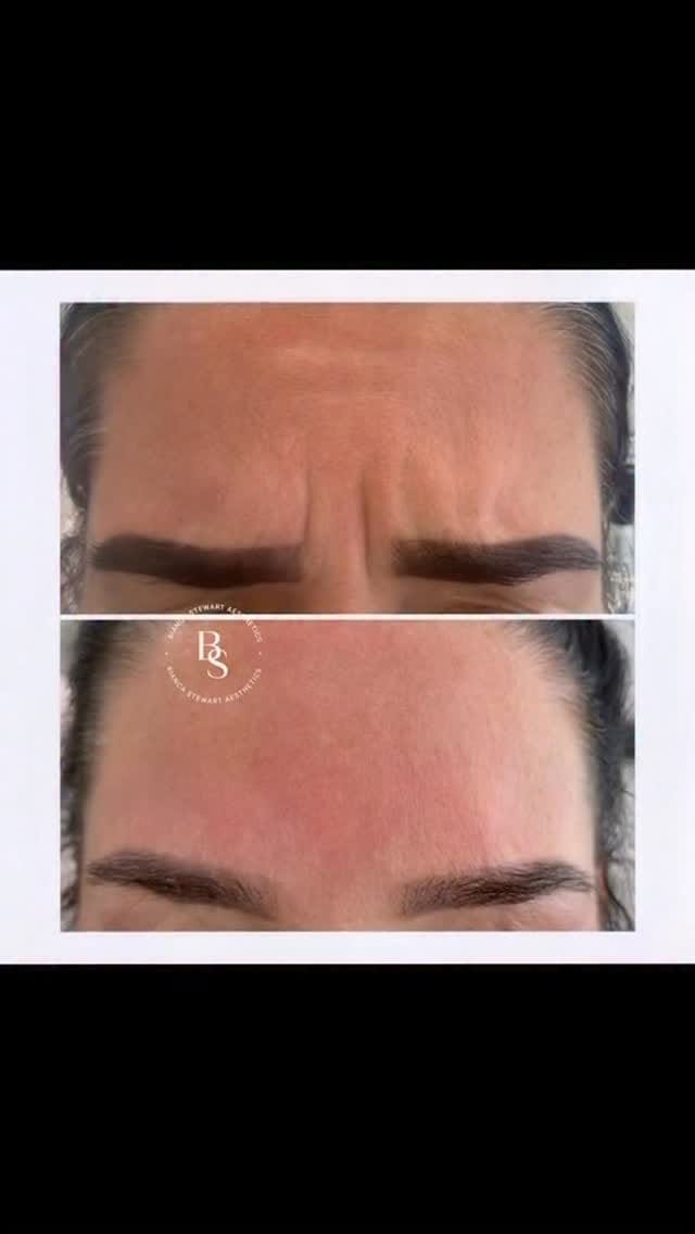 Post 2 by Bianca Stewart Aesthetics on Instagram (video)
