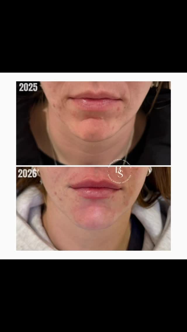 Post 3 by Bianca Stewart Aesthetics on Instagram (video)