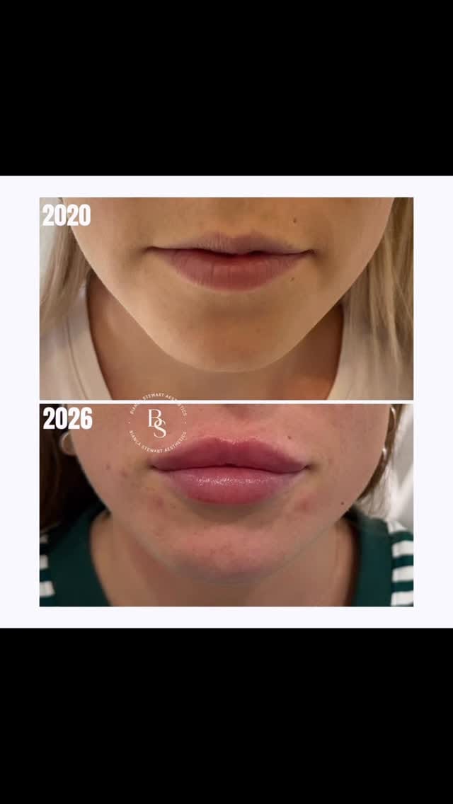 Post 1 by Bianca Stewart Aesthetics on Instagram (video)