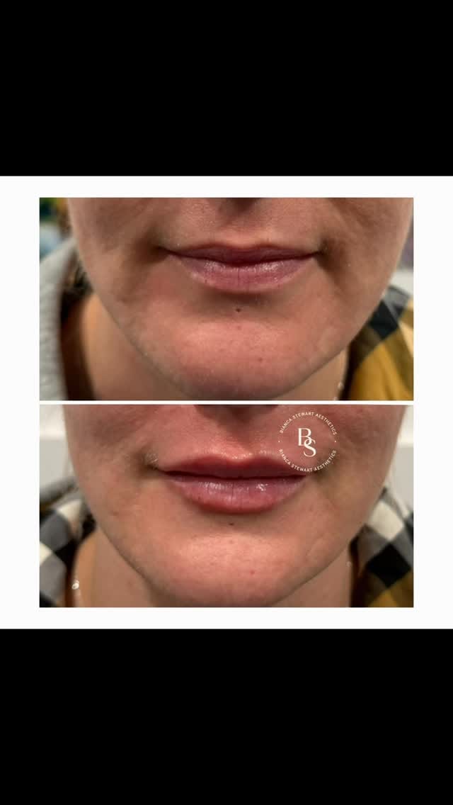 Post 8 by Bianca Stewart Aesthetics on Instagram (video)