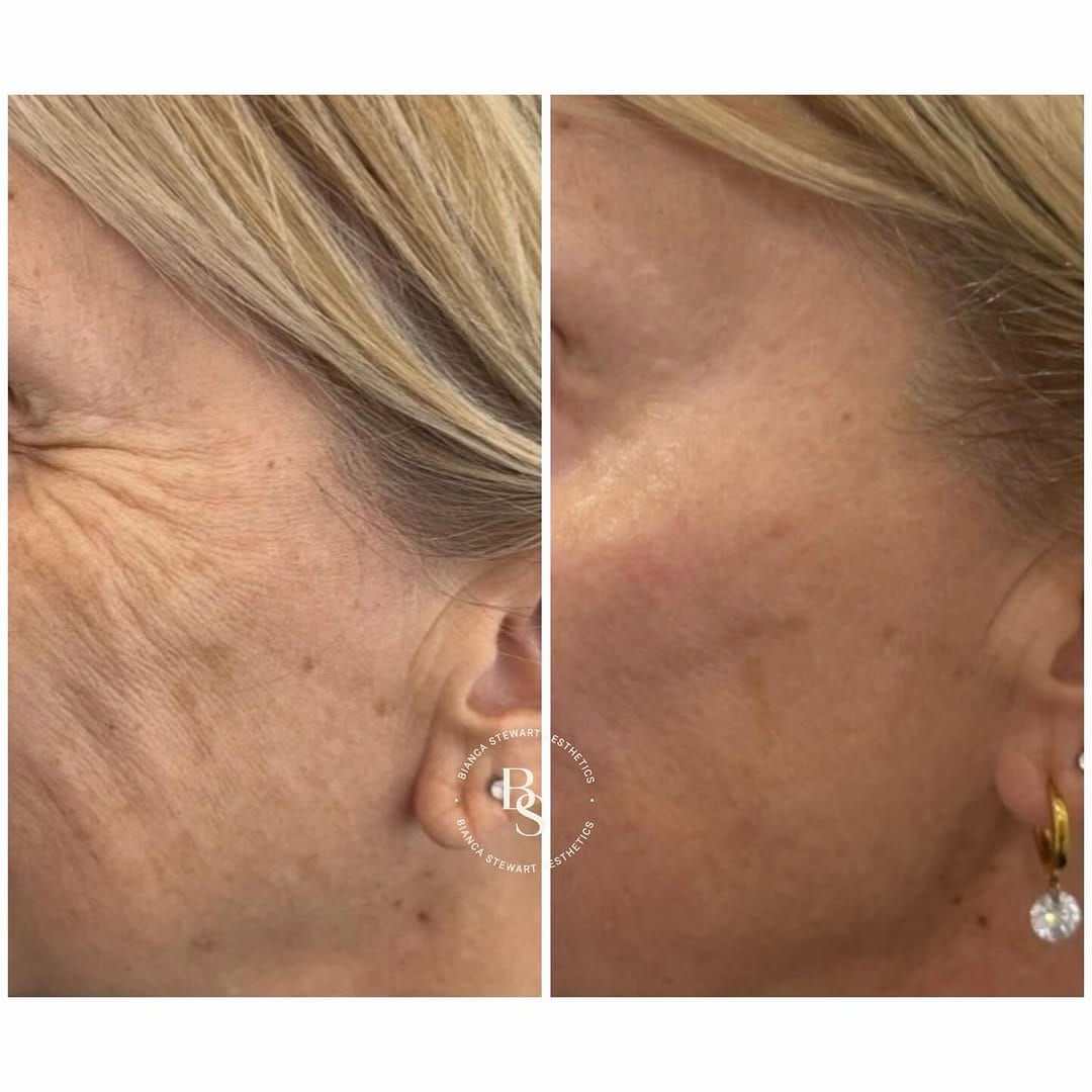 Post 5 by Bianca Stewart Aesthetics on Instagram (image)