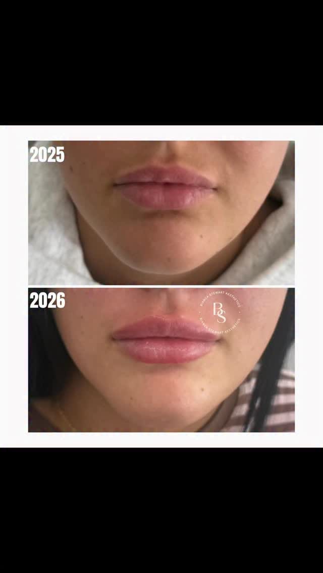 Post 6 by Bianca Stewart Aesthetics on Instagram (video)