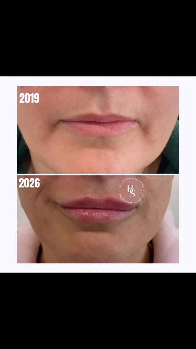 Post 10 by Bianca Stewart Aesthetics on Instagram (video)