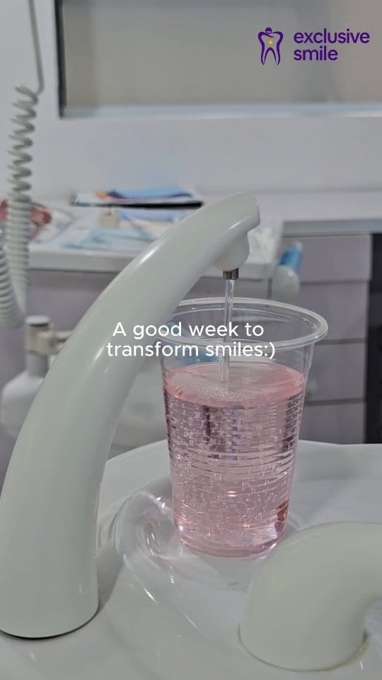 Post 8 by Exclusive Smile | Nigeria's #1 Smile Makeover Clinic on Instagram (video)