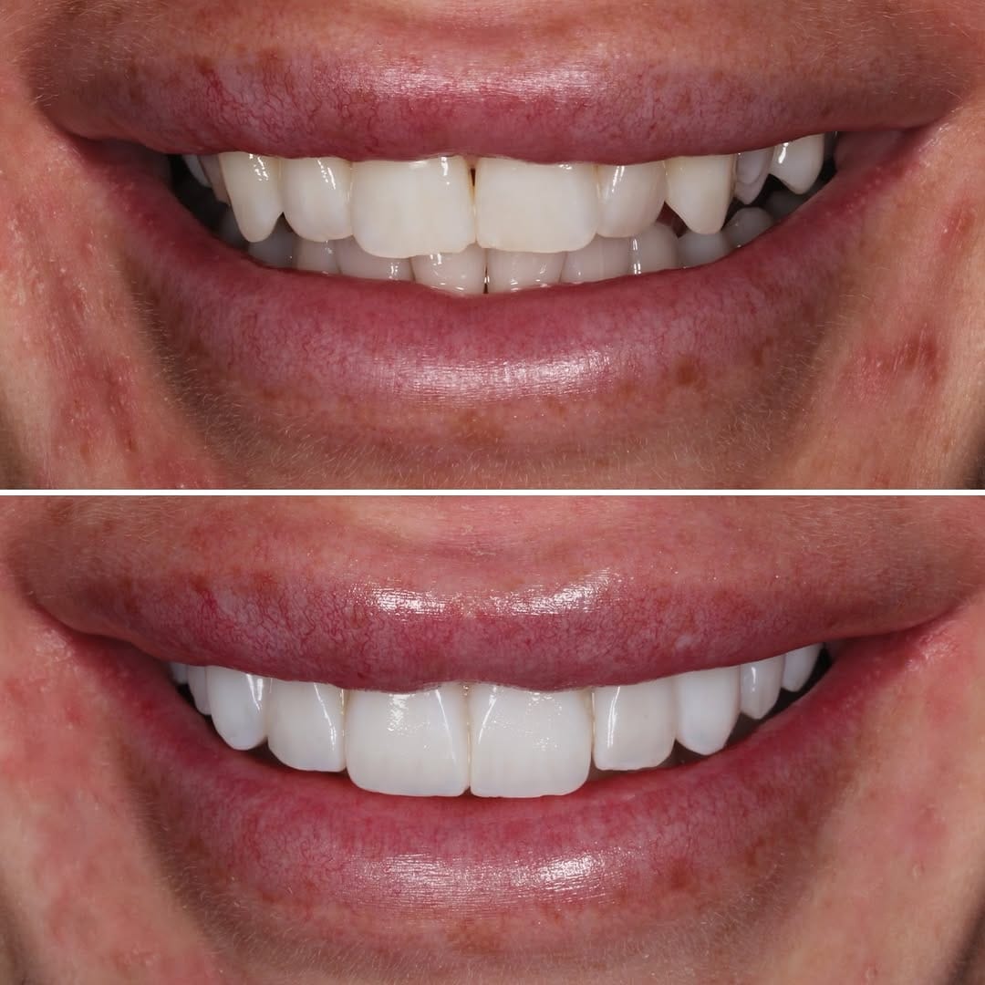 Post 9 by Newcastle Dental Care on Instagram (image)