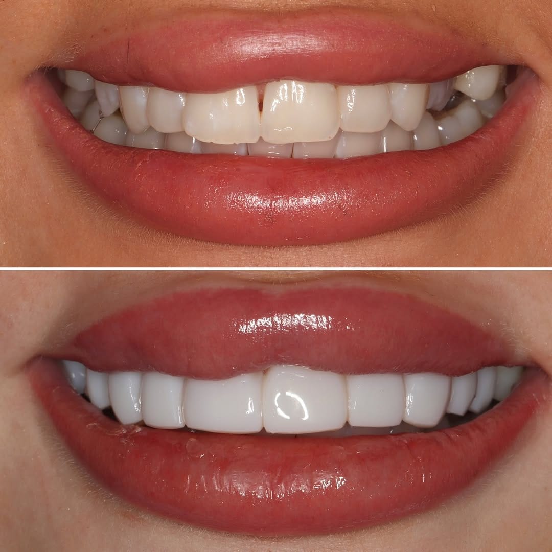 Post 7 by Newcastle Dental Care on Instagram (image)