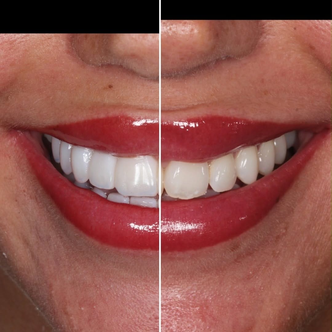 Post 8 by Newcastle Dental Care on Instagram (video)