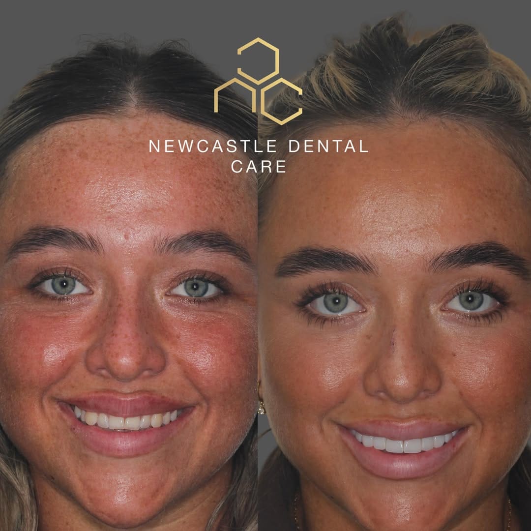 Post 2 by Newcastle Dental Care on Instagram (carousel)