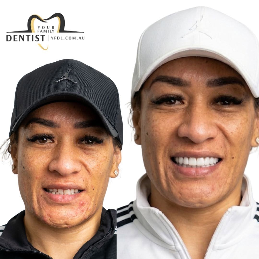 Post 1 by Your Family Dentist 🦷 on Instagram (image)