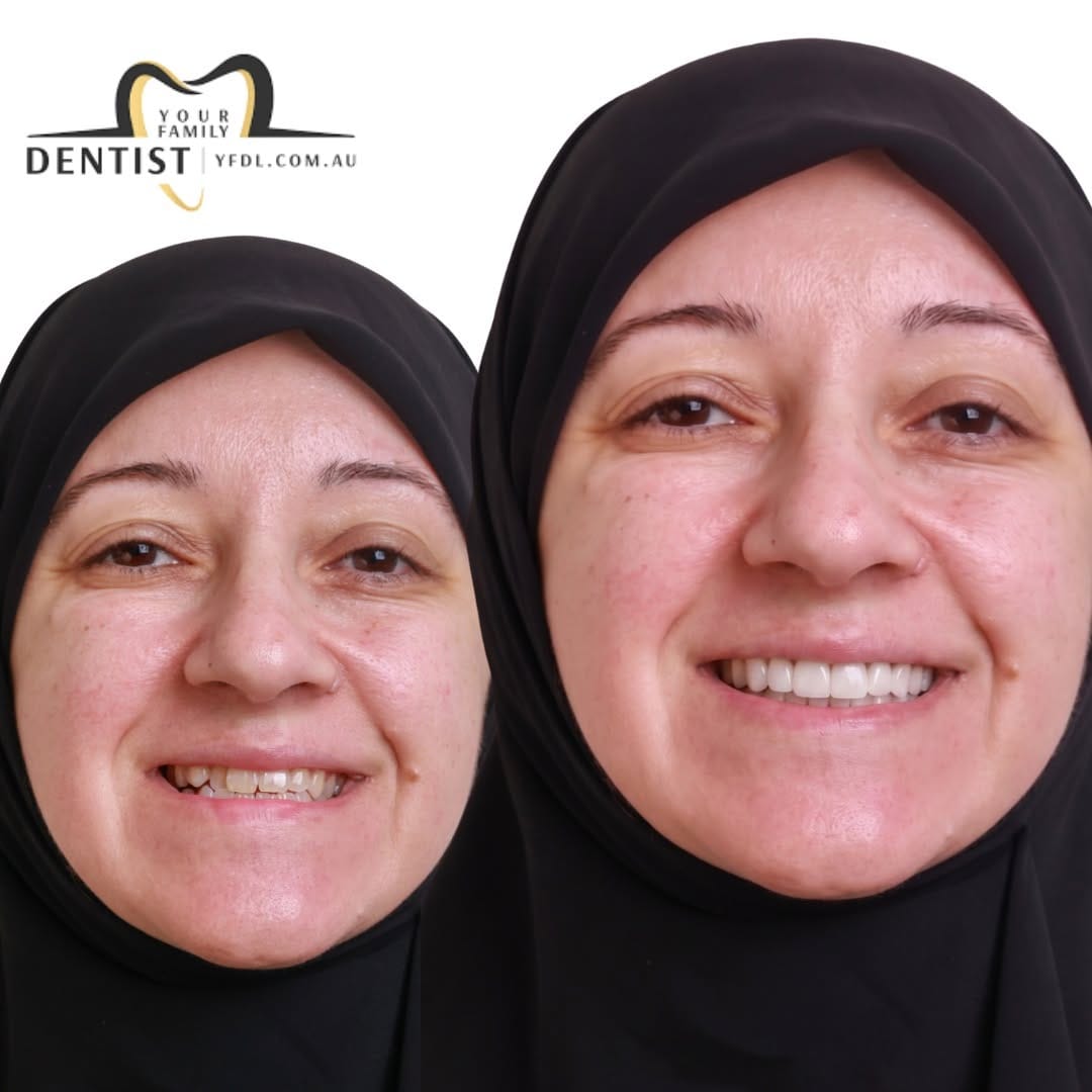 Post 6 by Your Family Dentist 🦷 on Instagram (image)