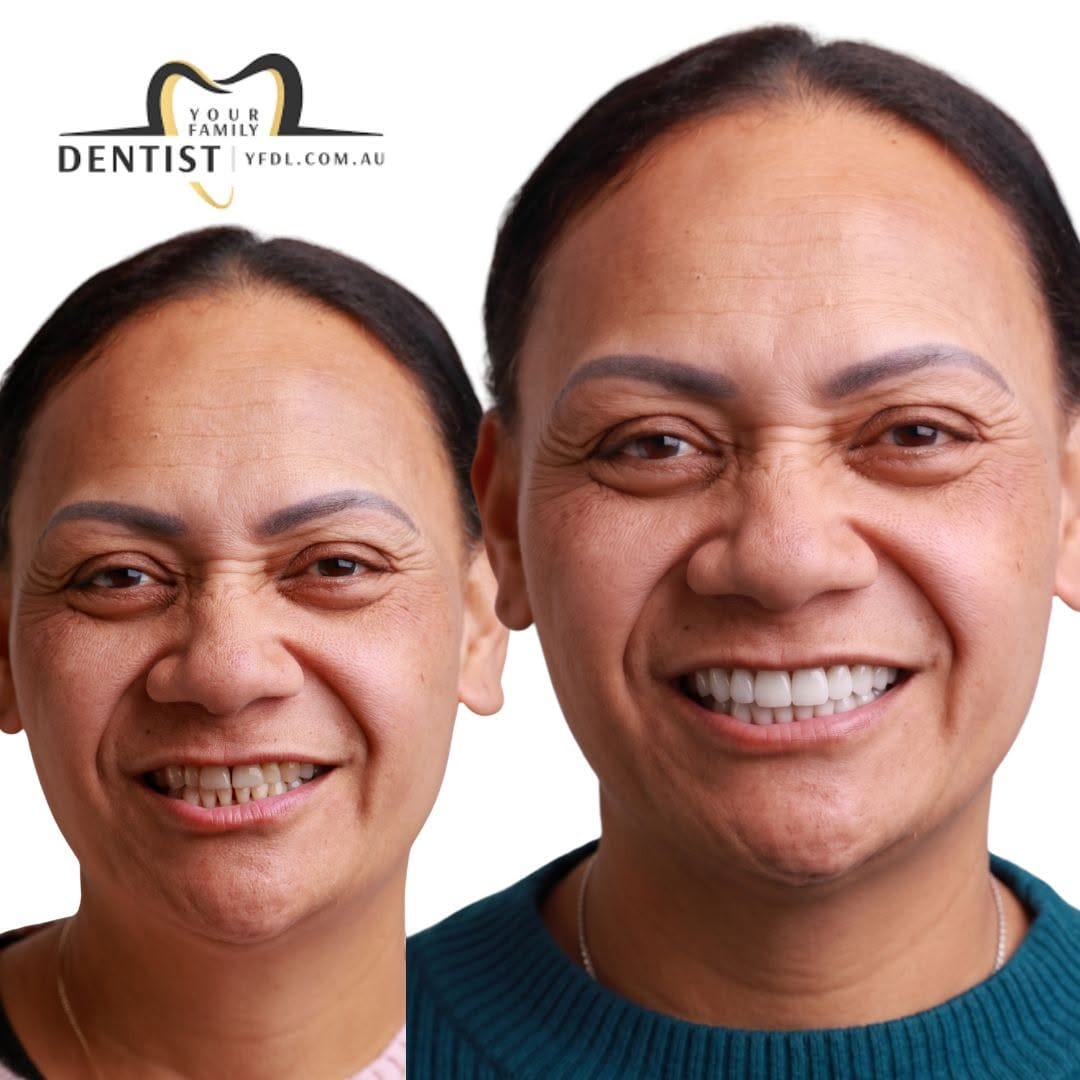 Post 10 by Your Family Dentist 🦷 on Instagram (image)
