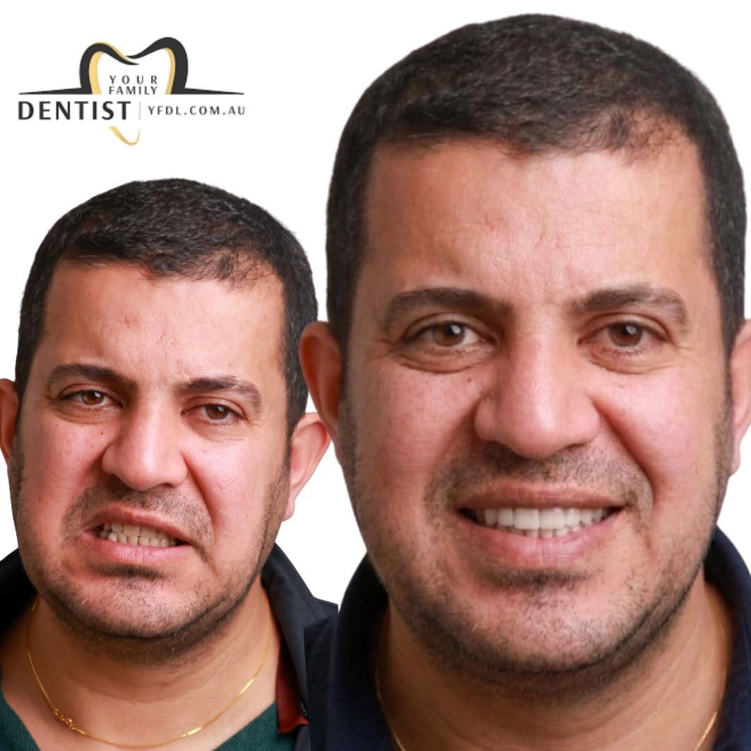 Post 4 by Your Family Dentist 🦷 on Instagram (image)