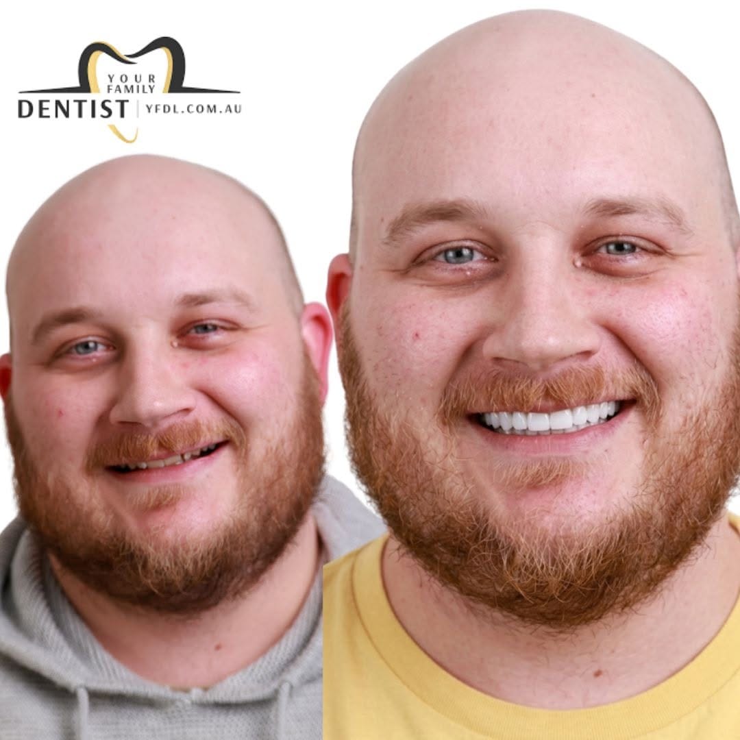 Post 7 by Your Family Dentist 🦷 on Instagram (image)