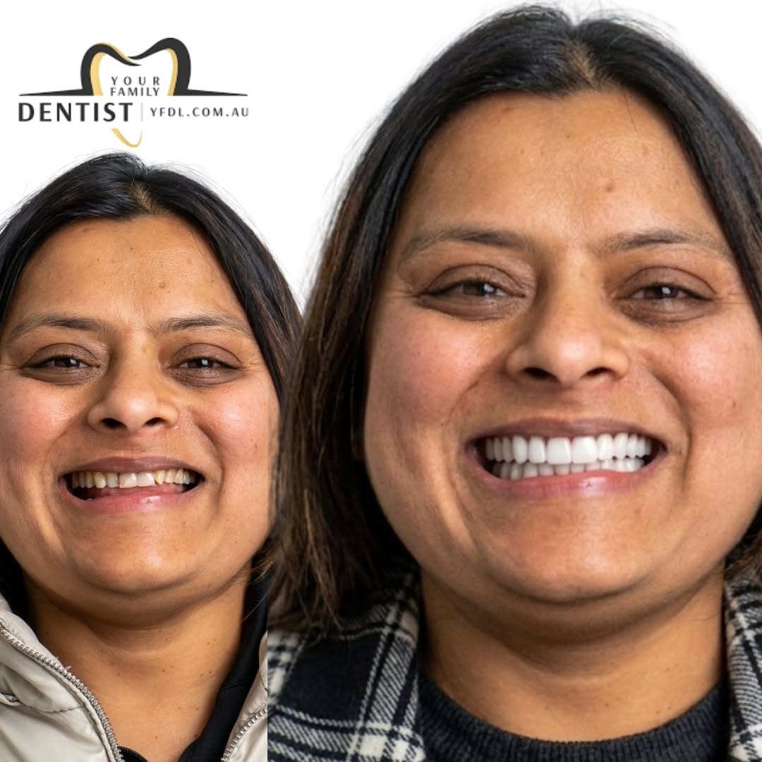 Post 3 by Your Family Dentist 🦷 on Instagram (image)