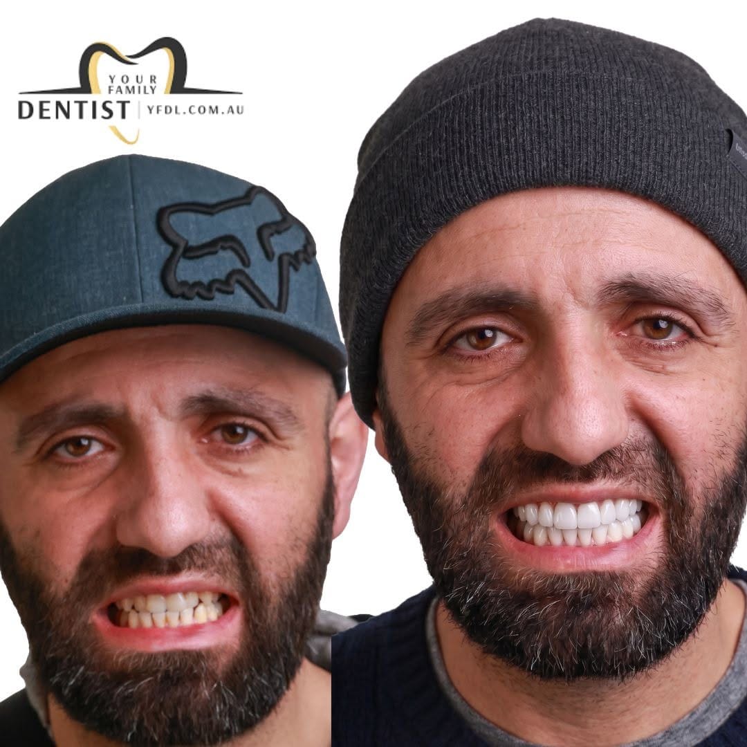Post 5 by Your Family Dentist 🦷 on Instagram (image)