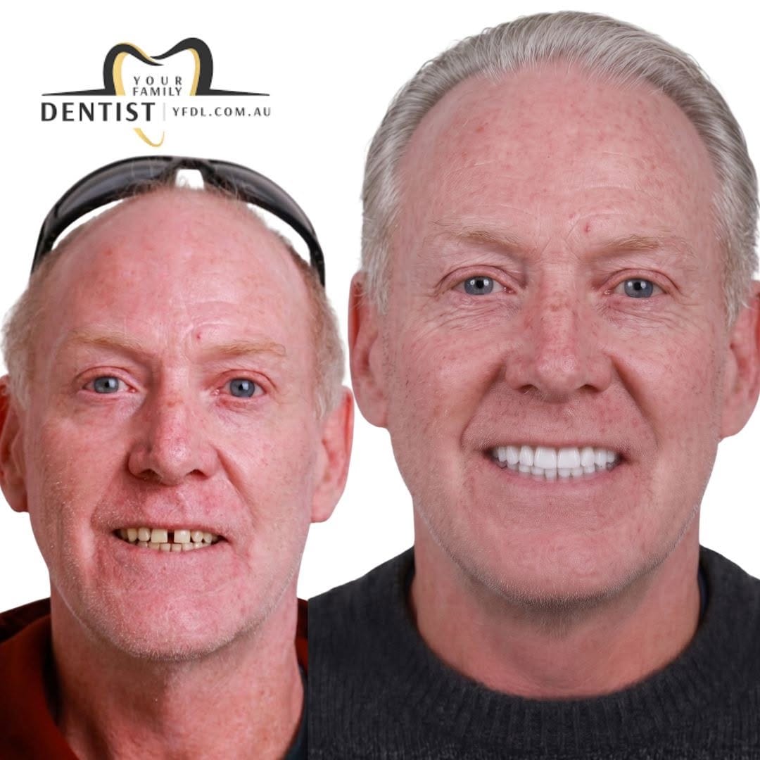 Post 8 by Your Family Dentist 🦷 on Instagram (image)