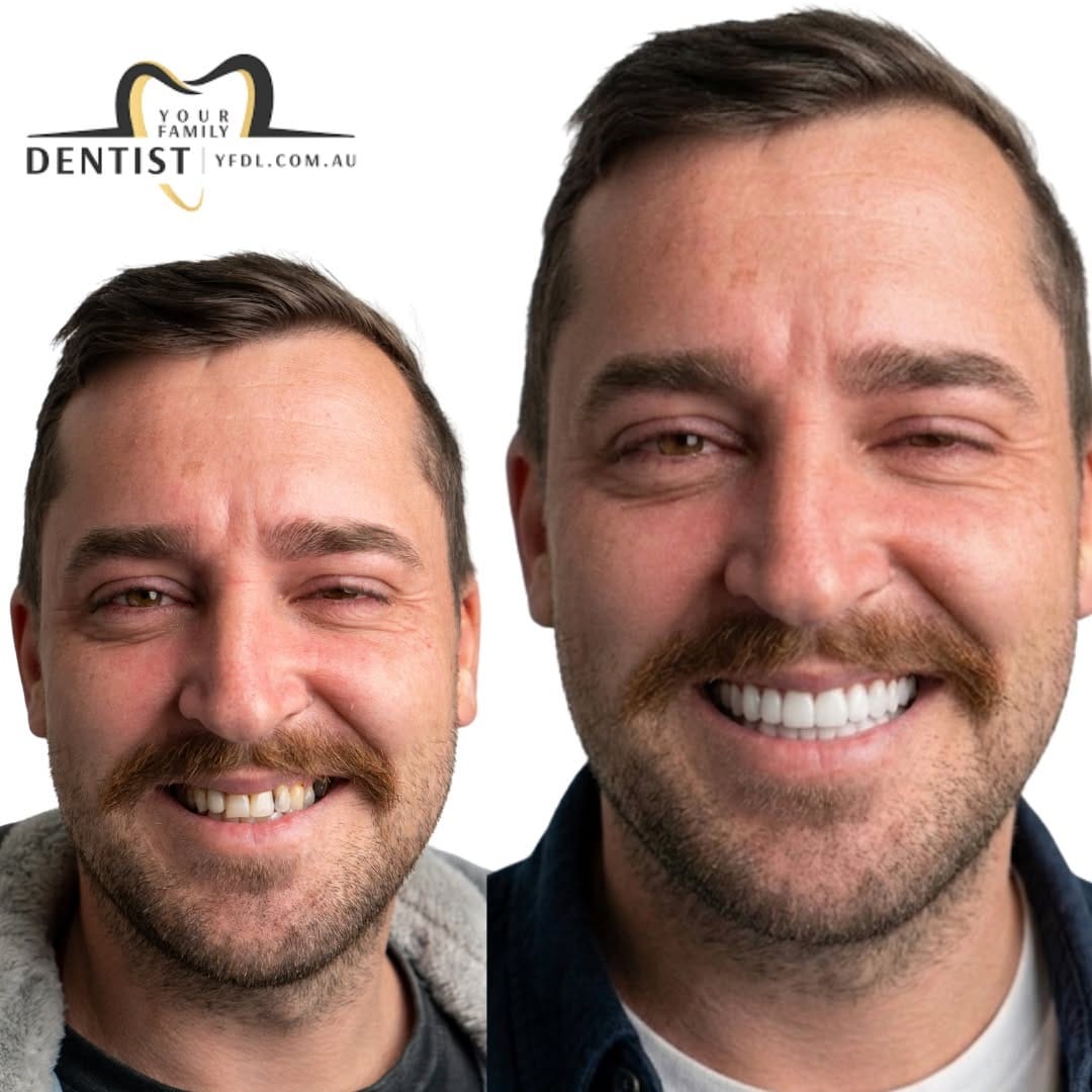 Post 2 by Your Family Dentist 🦷 on Instagram (image)