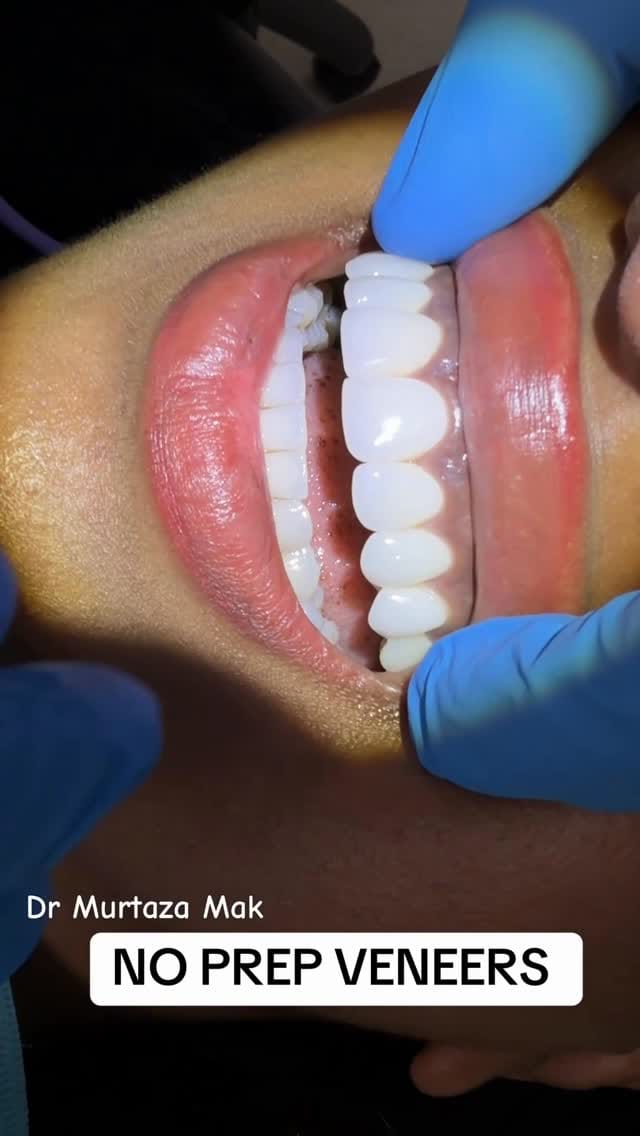 Post 6 by Dr. Murtaza Mak on Instagram (video)