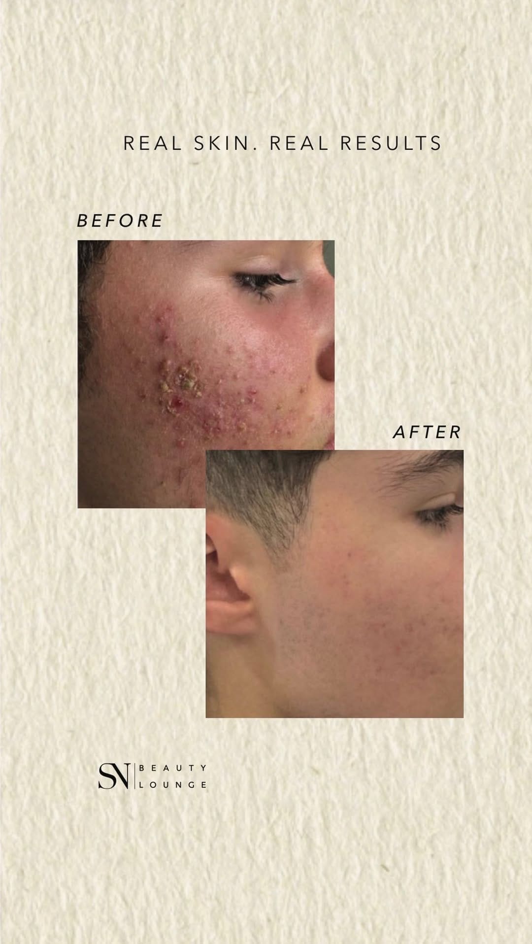 Post 10 by Melbourne Beauty & Cosmetic Clinic on Instagram (video)