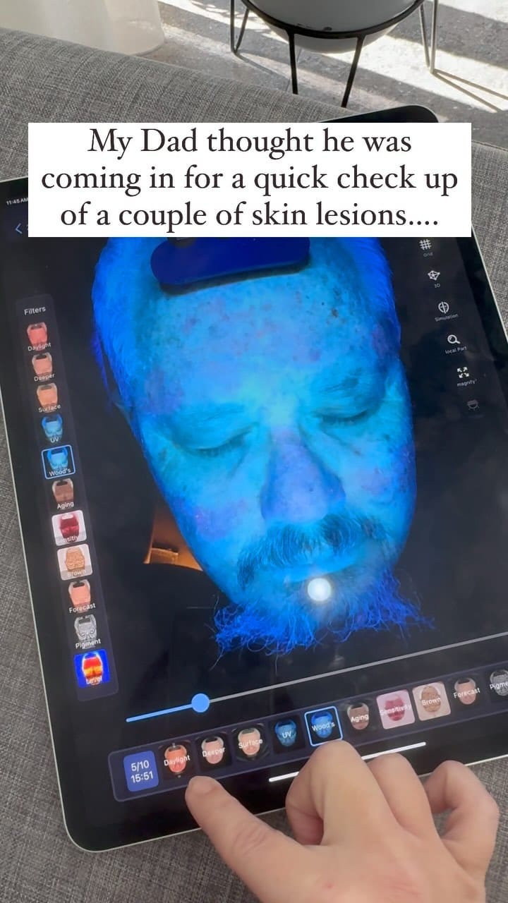 Post 4 by COSMETIC TATTOO and SKIN PERTH | Emma Rose Kiely on Instagram (video)