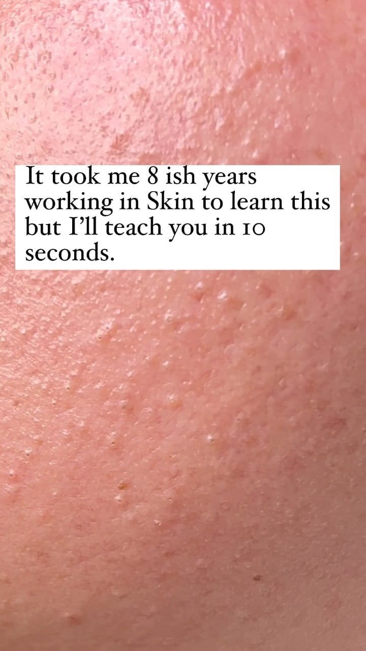 Post 5 by COSMETIC TATTOO and SKIN PERTH | Emma Rose Kiely on Instagram (video)