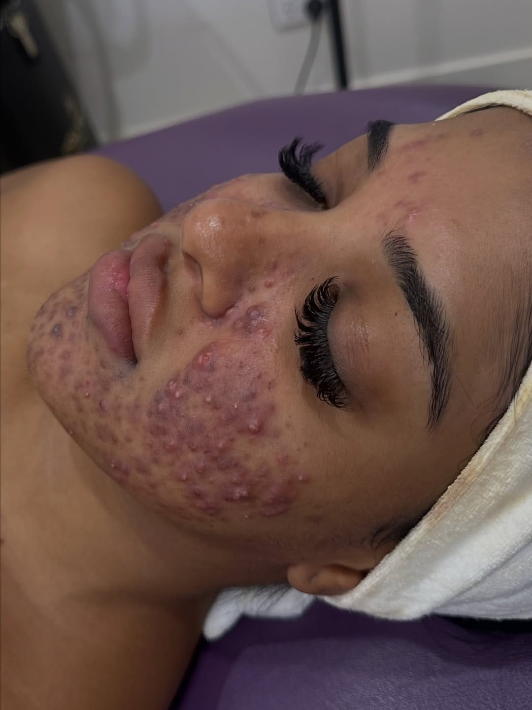 Post 8 by SDL Australia | Transformative Skin Correction & Longevity on Instagram (carousel)