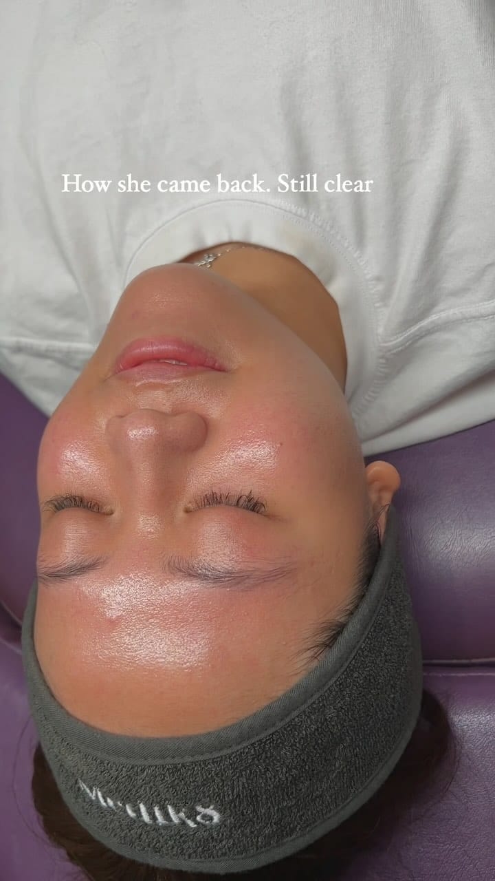 Post 10 by SDL Australia | Transformative Skin Correction & Longevity on Instagram (video)