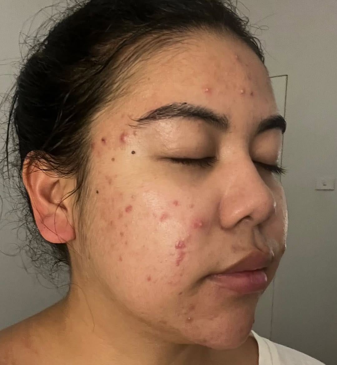 Post 3 by SDL Australia | Transformative Skin Correction & Longevity on Instagram (carousel)