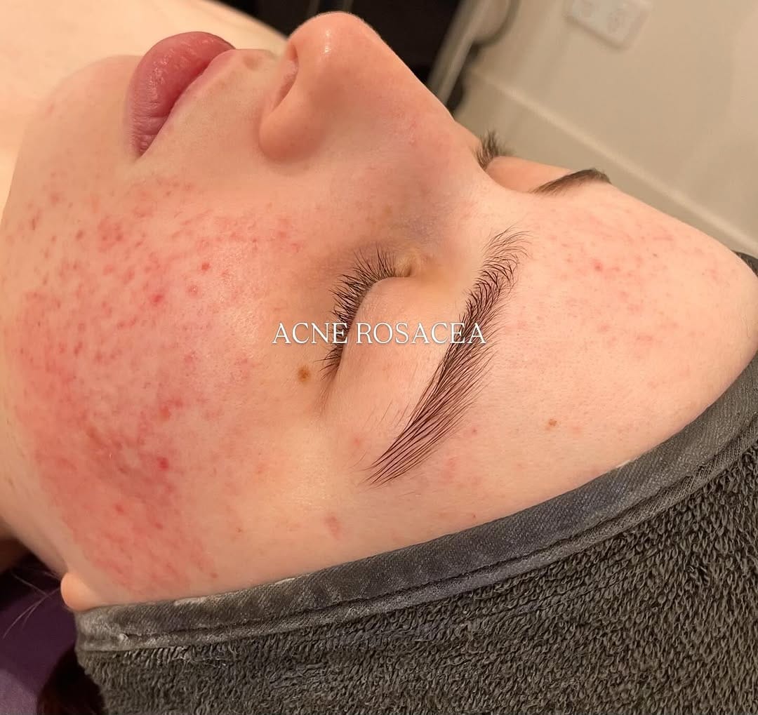 Post 6 by SDL Australia | Transformative Skin Correction & Longevity on Instagram (carousel)