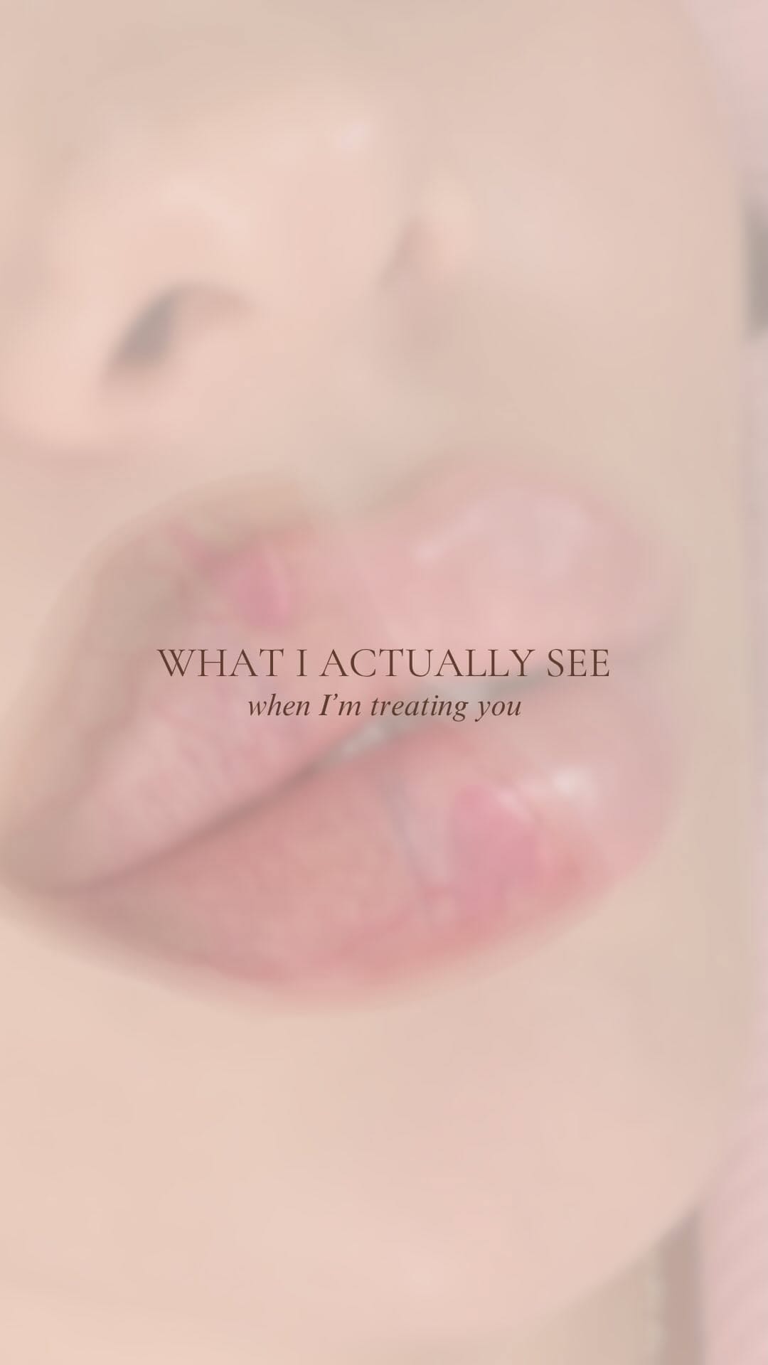 Post 1 by @aestheticsbyalice__ on Instagram (video)