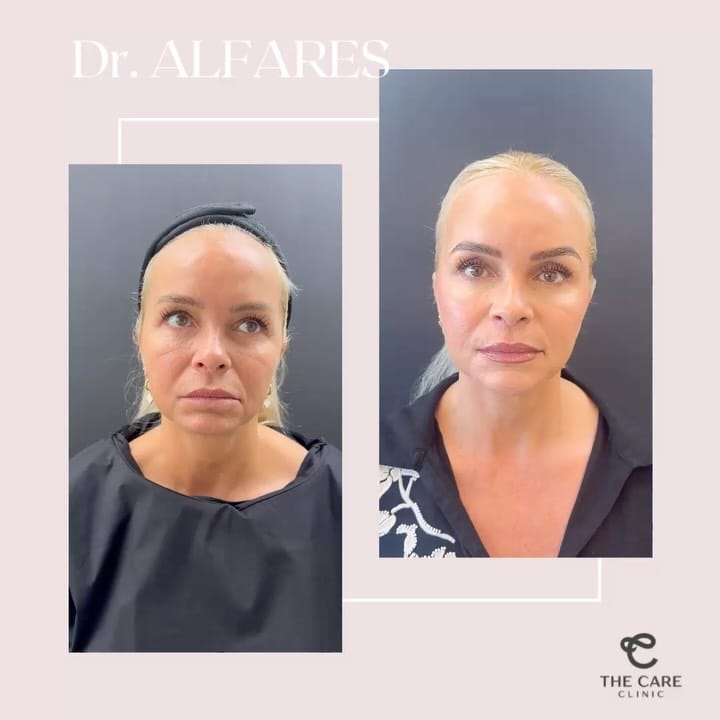 Post 8 by THE CARE CLINIC on Instagram (carousel)