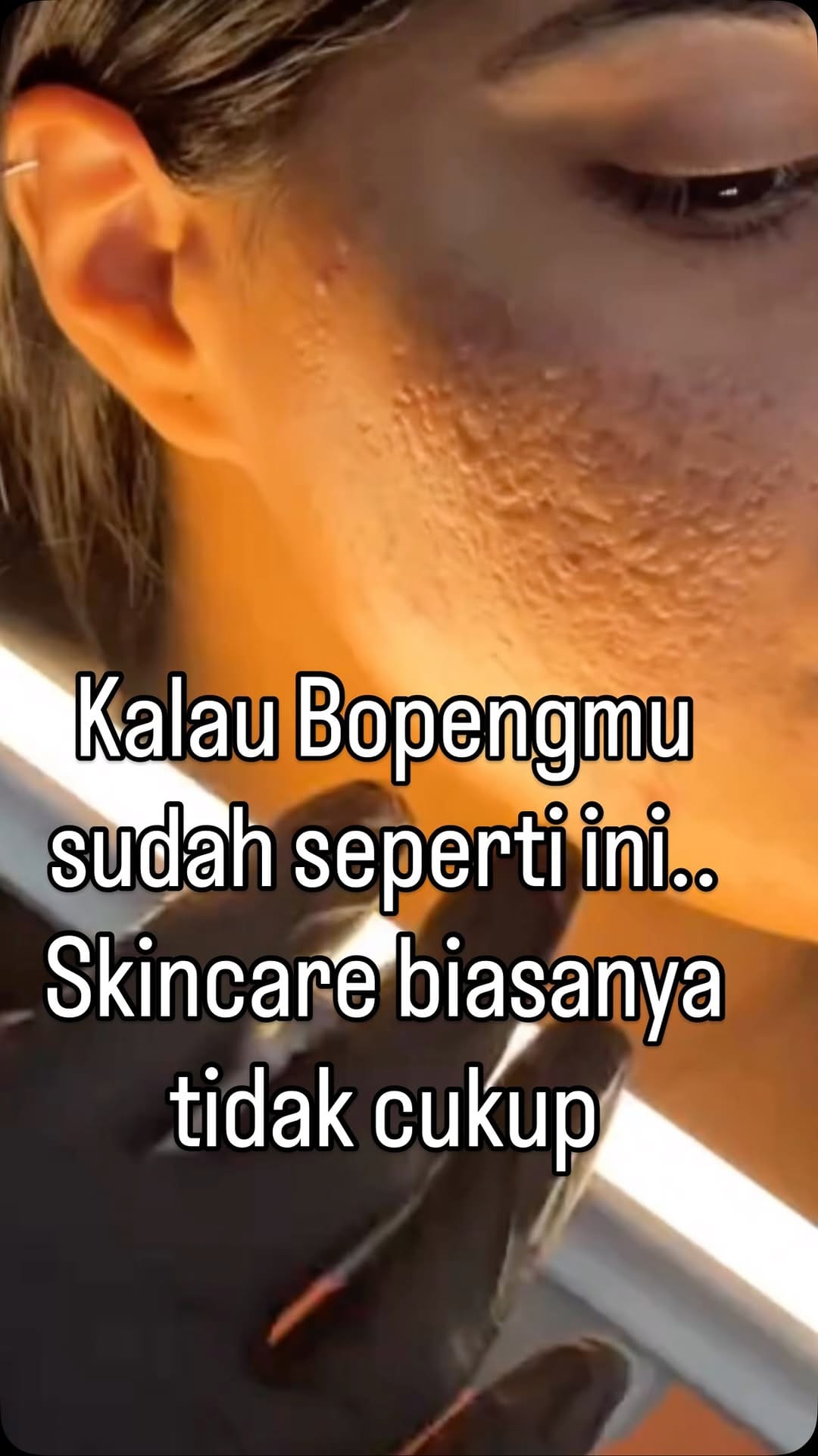 Post 3 by Klinik Mirabelle Kupang on Instagram (video)