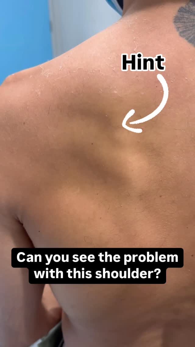 Post 2 by Perth Injury & Pain Clinic on Instagram (video)