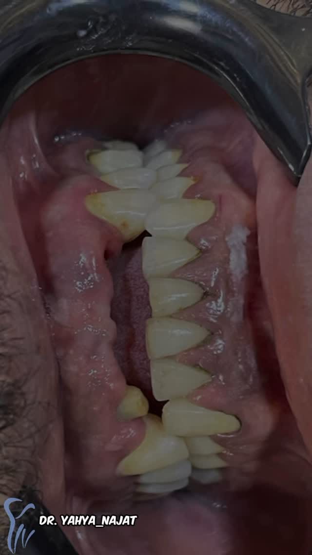 Post 6 by الدكتور يحيى نجاة محمد on Instagram (video)