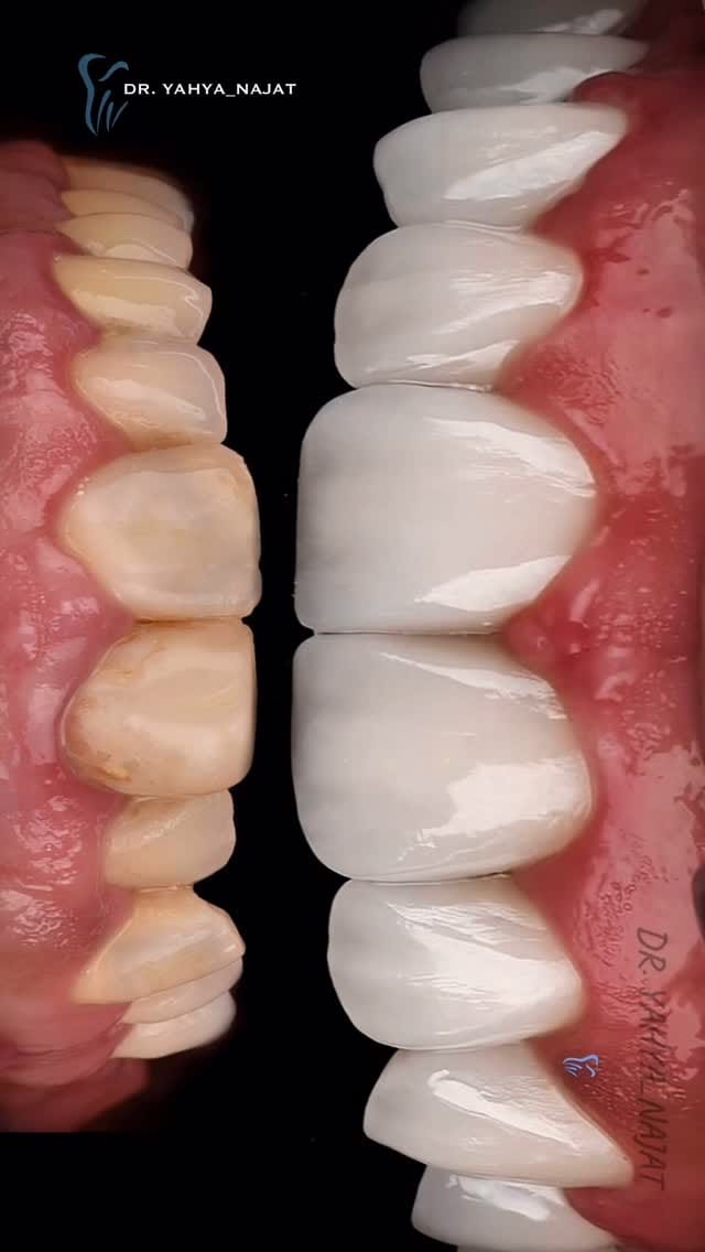 Post 3 by الدكتور يحيى نجاة محمد on Instagram (video)