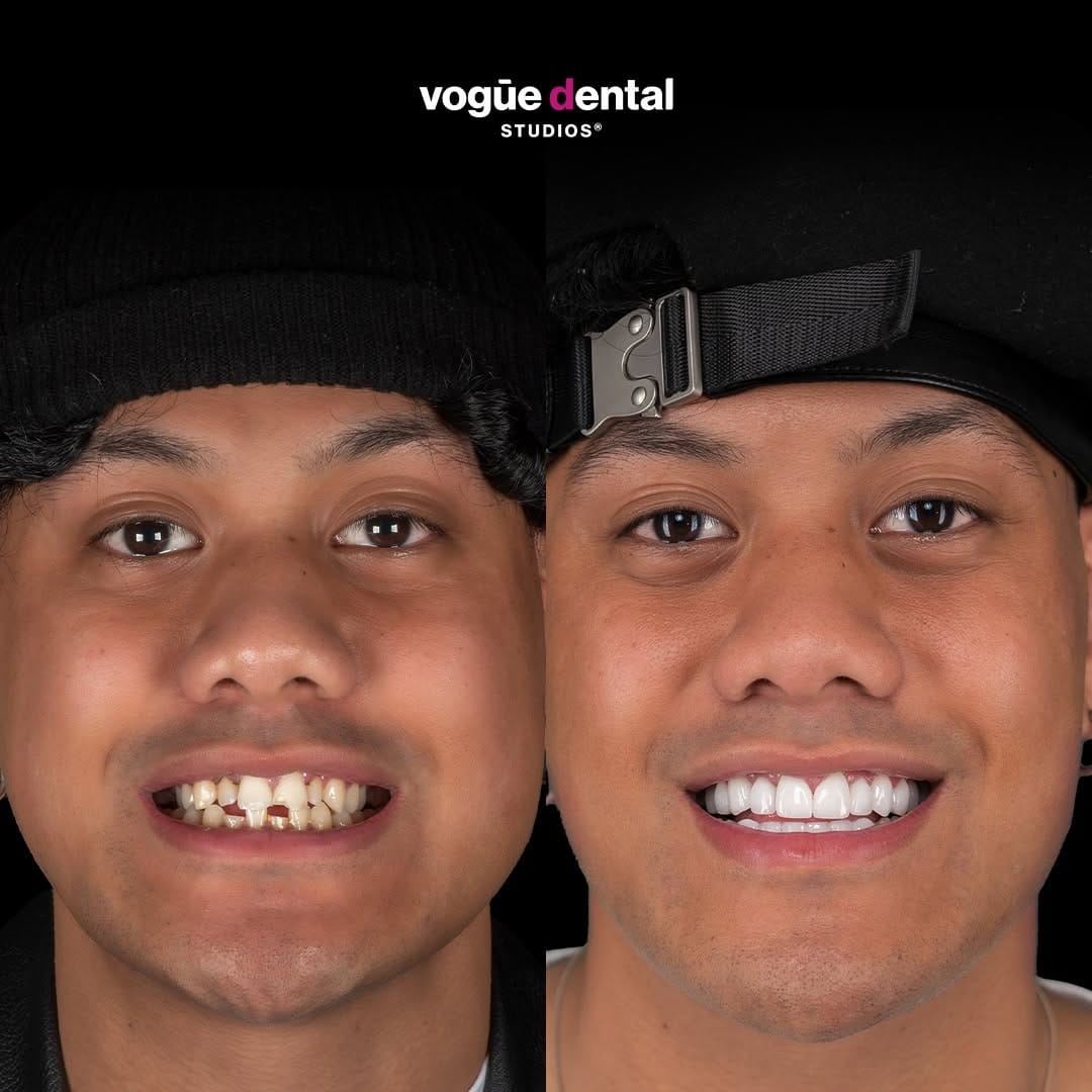 Post 6 by Vogue Dental Studios®️ on Instagram (carousel)