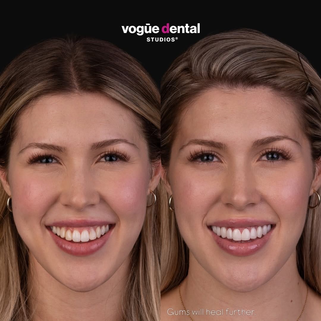 Post 7 by Vogue Dental Studios®️ on Instagram (carousel)